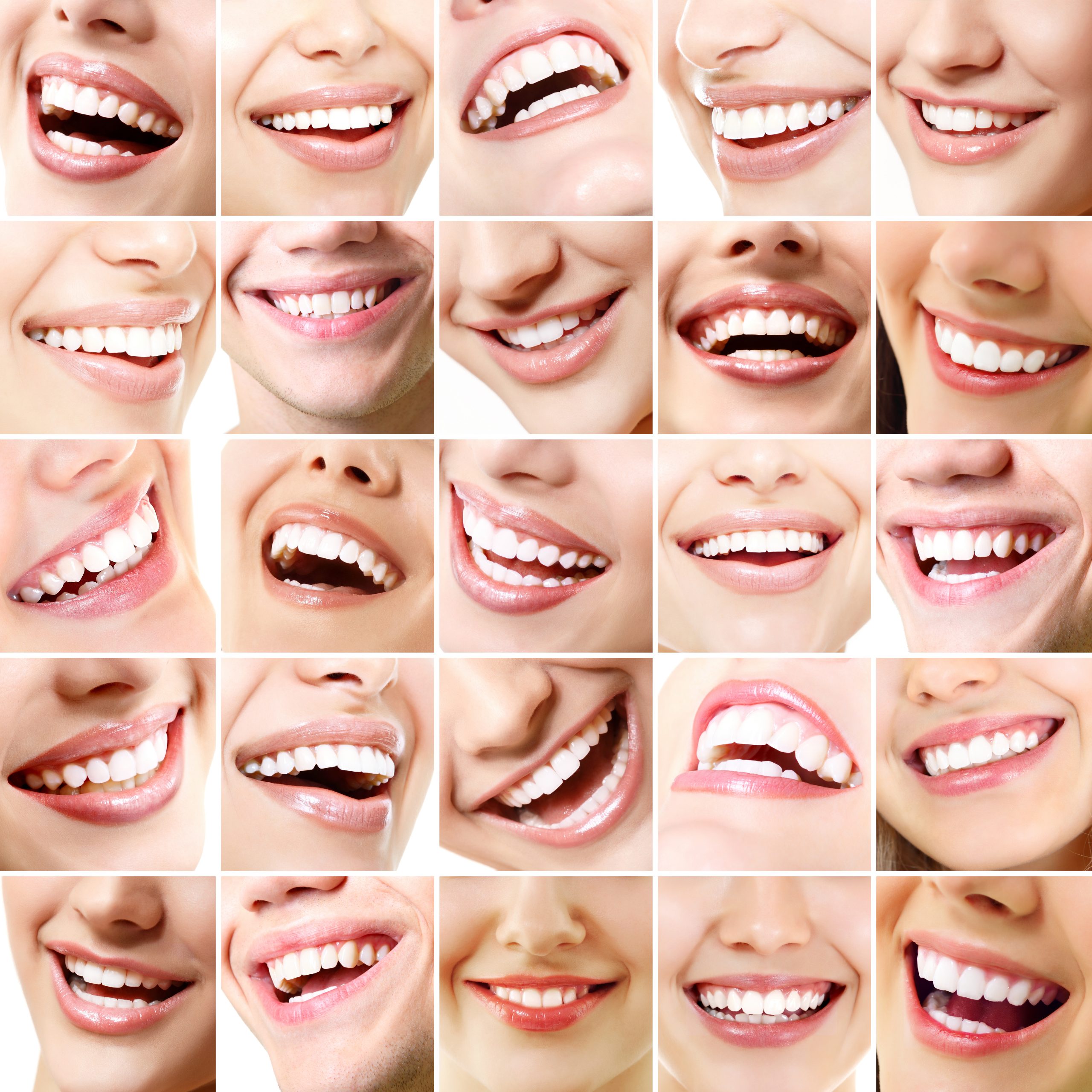 Как улыбаться с зубами. Красивые зубы. Красивые ровные зубы. Красивая улыбка зубы. Широкая улыбка красивые зубы.